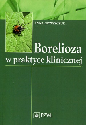 Borelioza w praktyce klinicznej