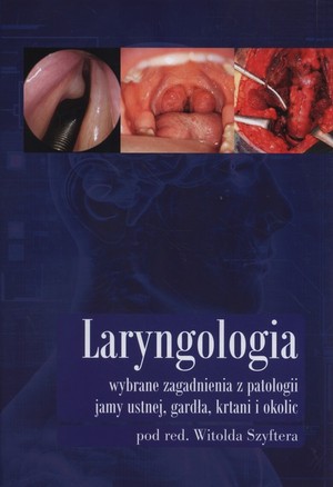 Laryngologia wybrane zagadnienia z patologii jamy ustnej, gardła, krtani i okolic