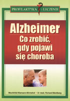 Alzheimer Co robić gdy pojawi się choroba