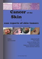Cancer of the Skin - case reports of skin tumors - epub, pdf