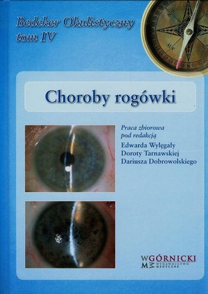 Choroby rogówki