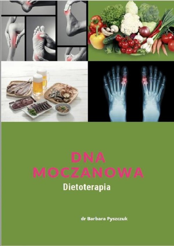 Dna Moczanowa - pdf Dietoterapia