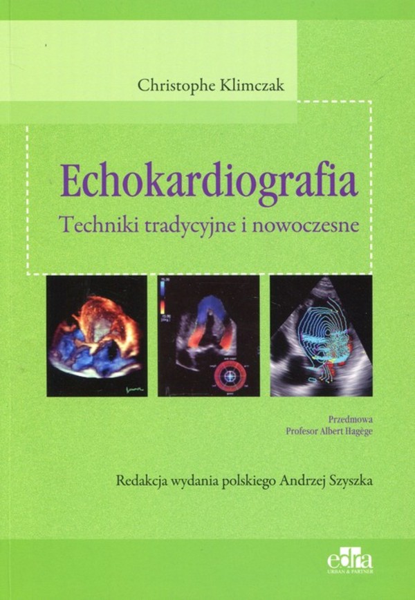 Echokardiografia. Techniki tradycyjne i nowoczesne