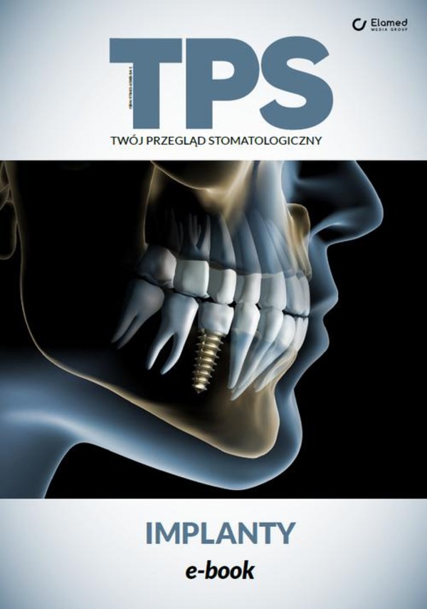 Implanty - pdf