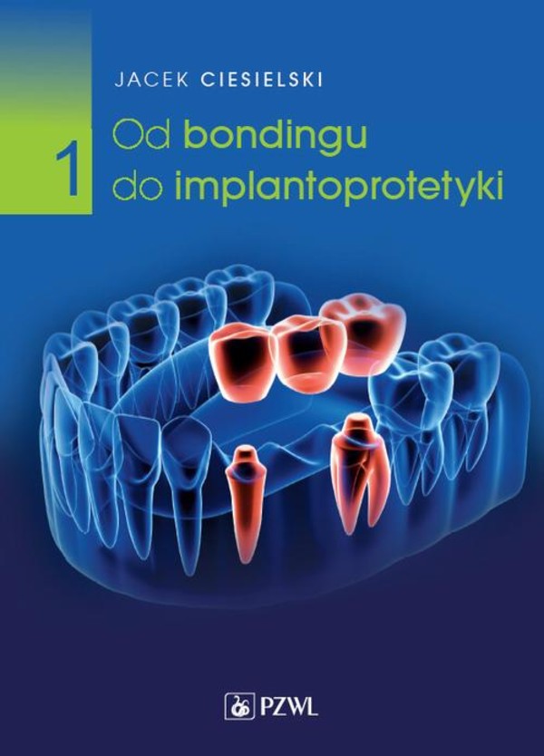 Od bondingu do implantoprotetyki Część 1 - mobi, epub, pdf