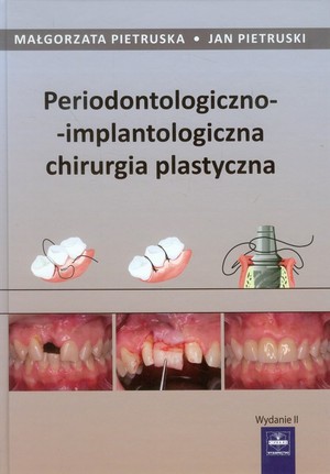 Periodontologiczno-implantologiczna chirurgia plastyczna