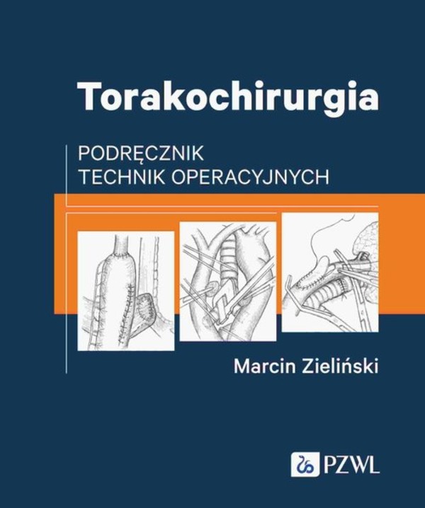 Torakochirurgia Podręcznik technik operacyjnych