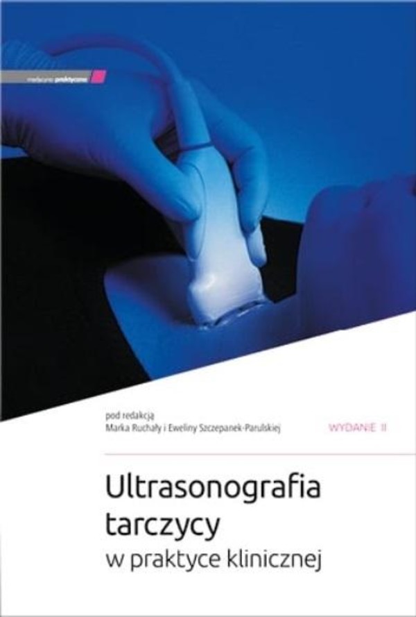 Ultrasonografia tarczycy w praktyce klinicznej