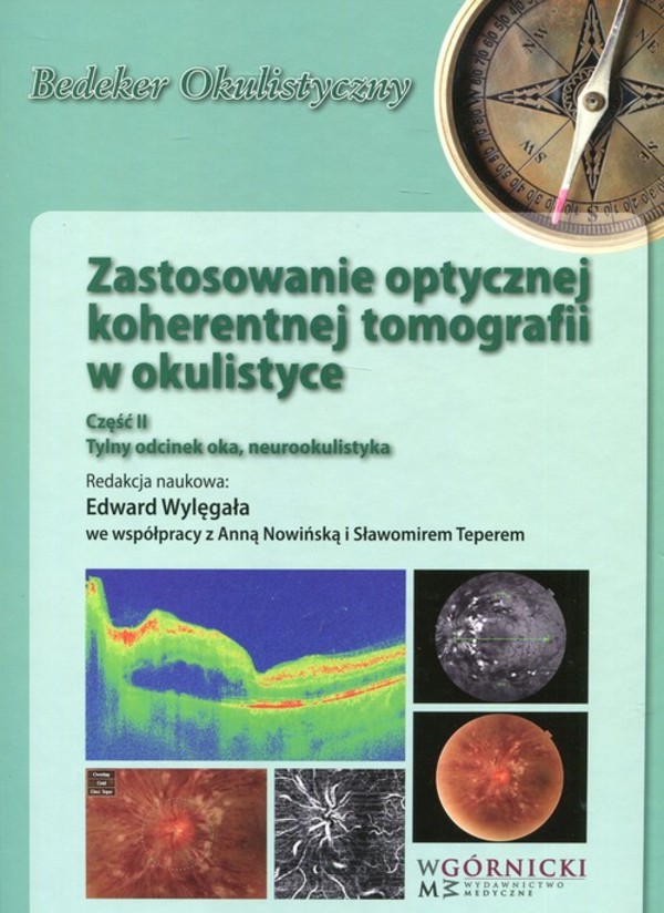 Zastosowanie optycznej koherentnej tomografii w okulistyce Część 2: Tylny odcinek oka, neurookulistyka
